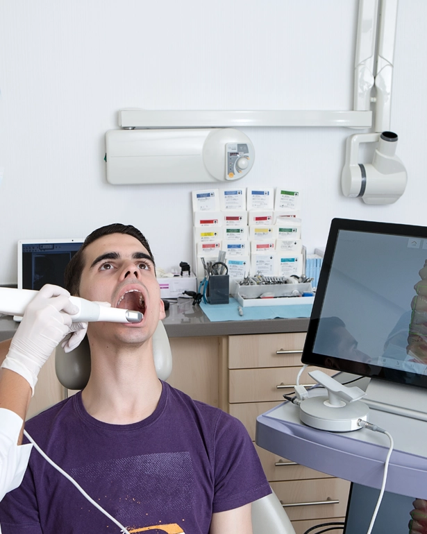 Intra-Oral Scanner
